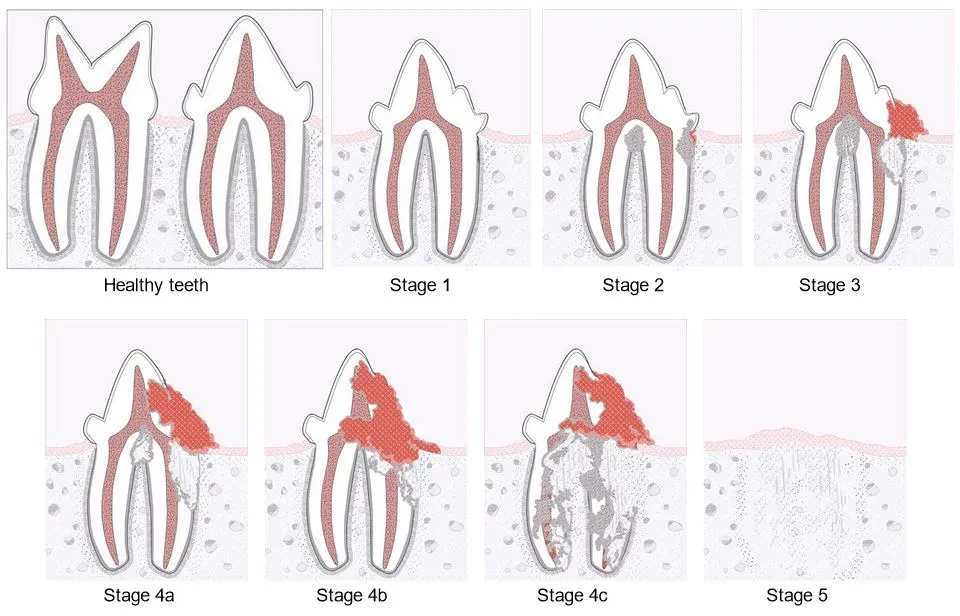 How can I tell whether my cat is suffering from tooth resorption?